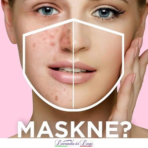 MASKNE: come alleviare l'acne da mascherina in modo naturale?